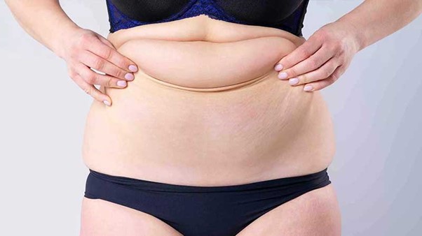 لیپوماتیک شکم و پهلو