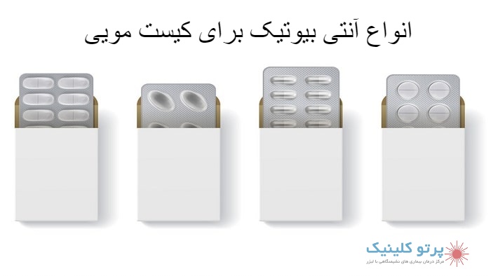 تزریق فنل برای کیست مویی