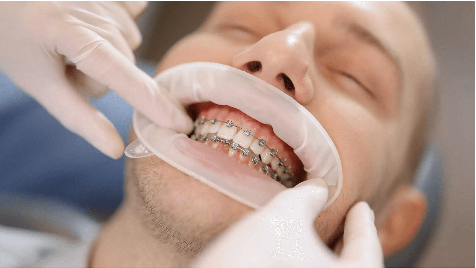 ارتودنسی دندان چیست؟